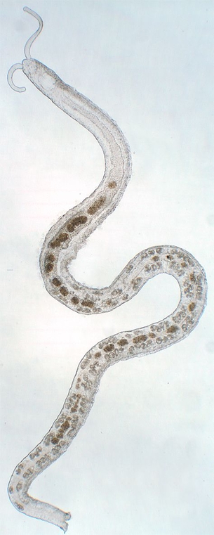 Ringelwurm der Gattung Protodrilus, welche normalerweise im interstitiellen System leben